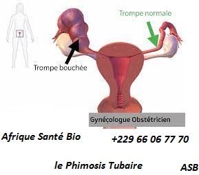 Phimosis Tubaire Traitement Naturel Avec Fruit 4 côté