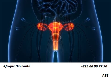 Bartholinite: Causes Symptômes et Traitement Naturel