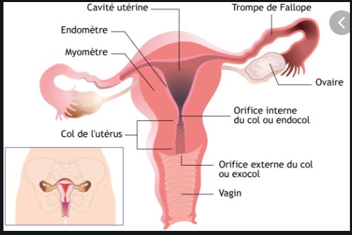 Traitement Possible Fibrome Utérin