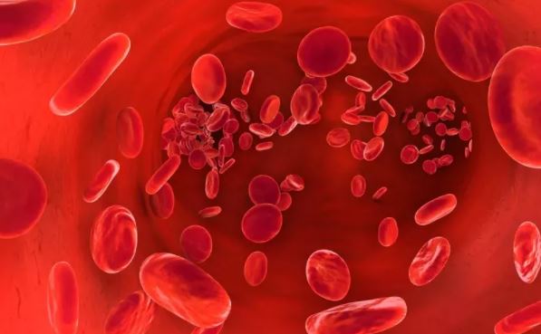 Thrombocytémie Définition Traitement Naturel Thrombocytémie