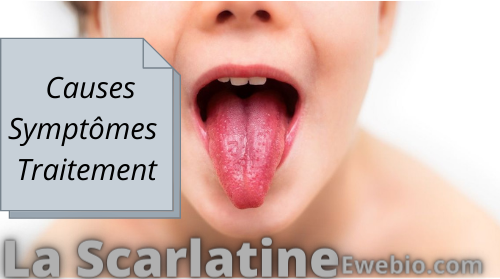 Remède Naturelle pour La Scarlatine