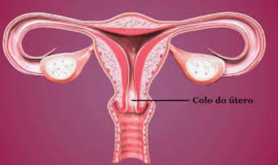 Soigner leSoigner le Cancer du col de L'utérus
